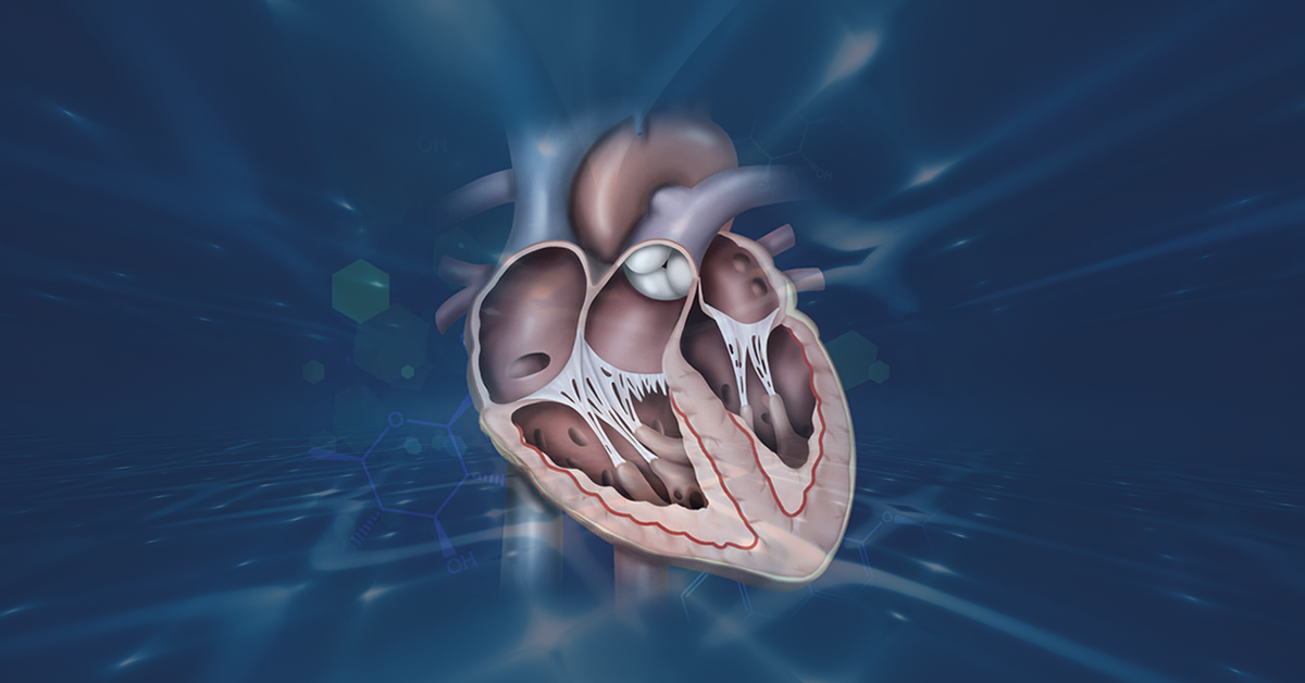 what-causes-heart-failure-with-preserved-ejection-fraction-hfpef